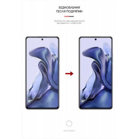 Гідрогелева плівка ArmorStandart для Xiaomi 11T (ARM61159)